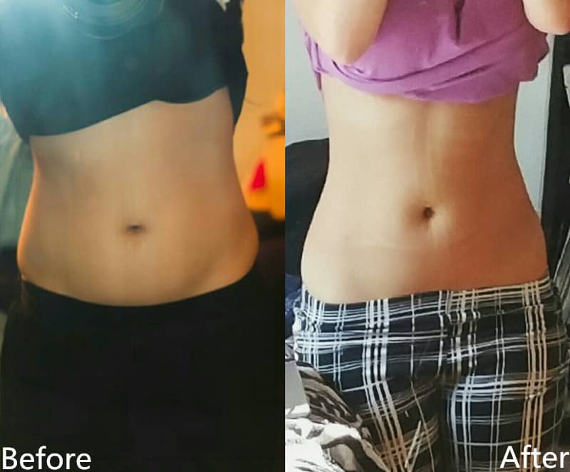 Read more about the article Before & After Effects of Waist Trainer Wearers
