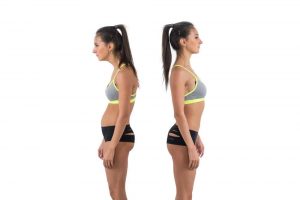 Woman with impaired posture position defect scoliosis and ideal bearing.
